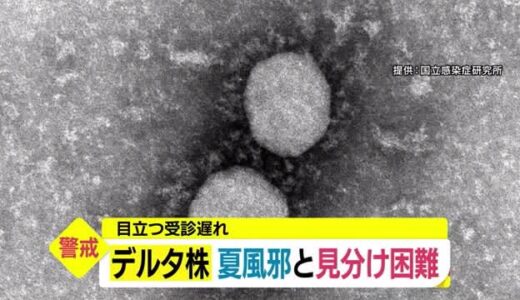 【新型コロナ詳報】デルタ株疑い急増　鳥取県が風邪症状でも検査呼びかけ