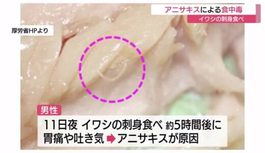 イワシの刺身に「アニサキス」…食べた男性が食中毒症状　鳥取県内で相次ぎ注意呼びかけ（倉吉市）