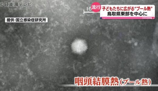 コロナの症状に似ている？プール熱とは？　山陰でも流行か