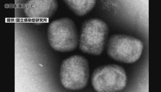 増加するサル痘　コロナとの違いや対策は？　海外との行き来の活発化が原因か　鳥取県鳥取市