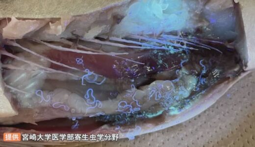 サバの腹を開くと…約200匹の「アニサキス」　衝撃映像投稿の理由「冬季にアニサキス食中毒多い」専門家警鐘　「酢でしめても、塩漬けにしてもアニサキスは生きている」