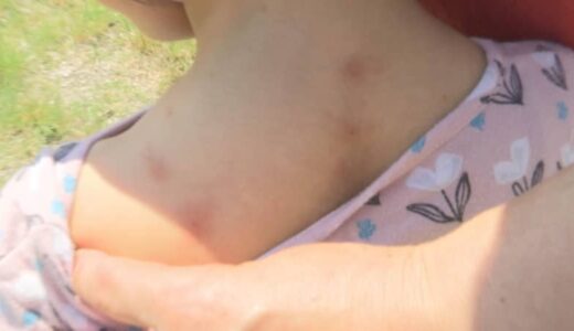 蚊よりも厄介、刺されると赤くなり長時間激しいかゆみ「ヌカカ」・別名「スケベ虫」大量発生　ドローンで石灰散布すると…「幼虫が半減」効果