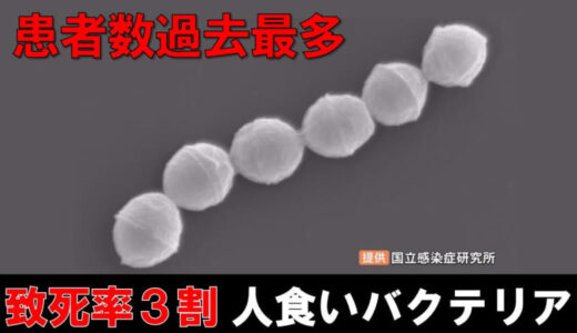 致死率30％「人食いバクテリア」患者数過去最多…「劇症型溶血性レンサ球菌」地方でも感染拡大の兆し　症状は？対策は？