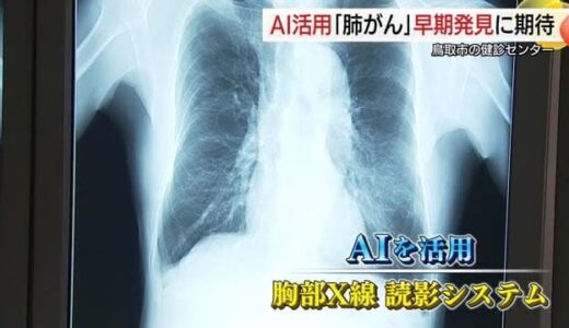 肺がん早期発見に「AI＝人工知能」活用…中四国地方で初めて鳥取県保健事業団が医師支援システム導入