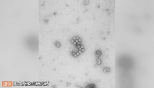 ノロウイルス集団食中毒相次ぐ　トイレでの感染、特に警戒を…医師指摘　トイレの水洗レバーにもウイルス付着　SNSで度々話題…「トイレットペーパー三角折」はやめた方が良い？